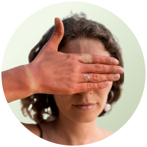 Skin Tan and Sun Damage